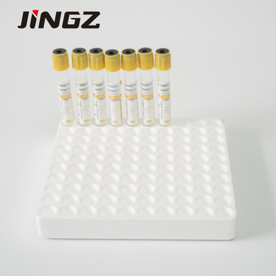 ガラス ペット病院のための黄色い上の血清の分離器の管5 Ml SSTの管