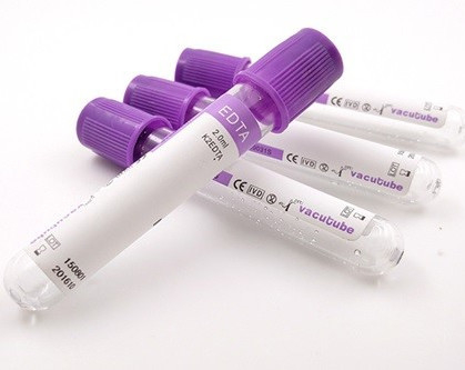 高度に従う血液検査の真空のためのJINGZ 0.5ml-10ml K2のエチレンジアミン四酢酸の管